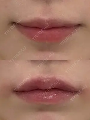 0 days after image