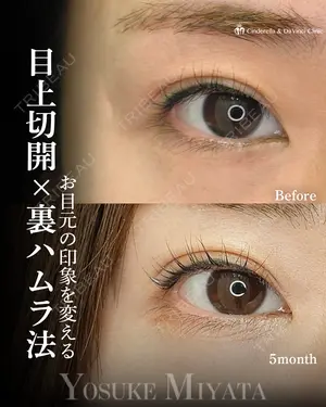 150 days after image