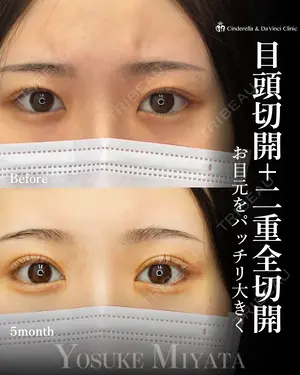 150 days after image