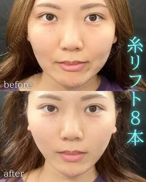 before image