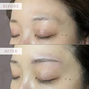 before image