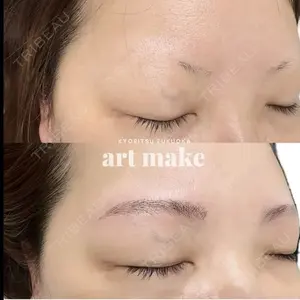 before image