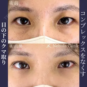 before image