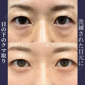 null days after image