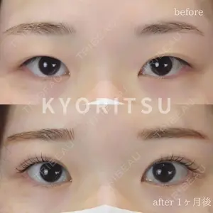 before image