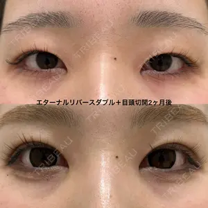 before image