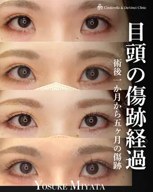 150 days after image