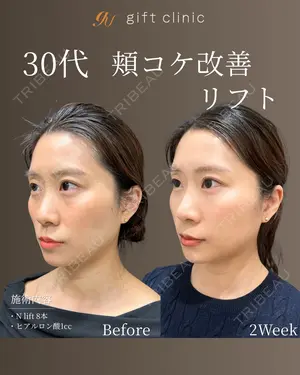 14 days after image