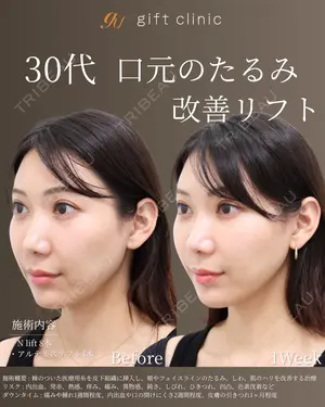 7 days after image