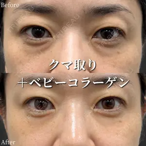 before image