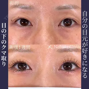 before image