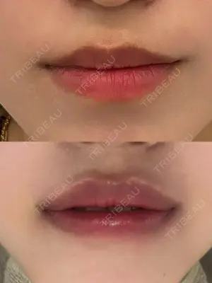 0 days after image