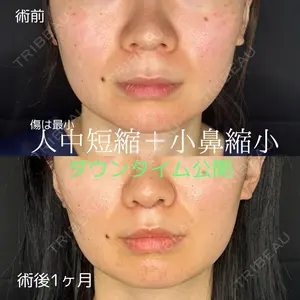 30 days after image
