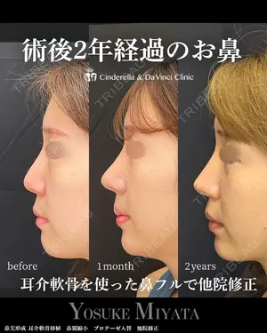 730 days after image