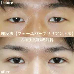 before image