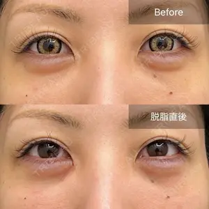 before image