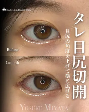 30 days after image