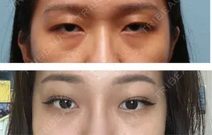 before image