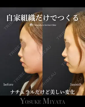 150 days after image