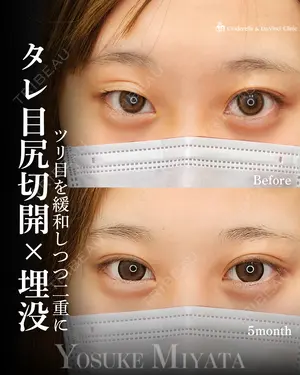 150 days after image