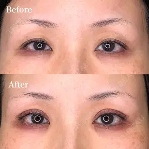 before image