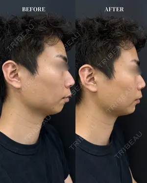 before image