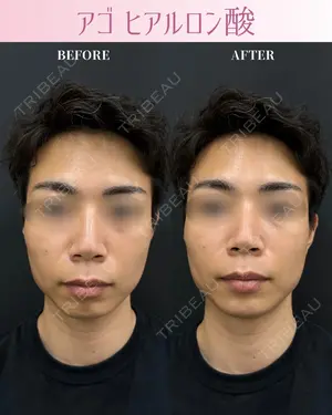 0 days after image