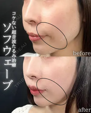30 days after image