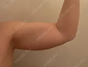 before image