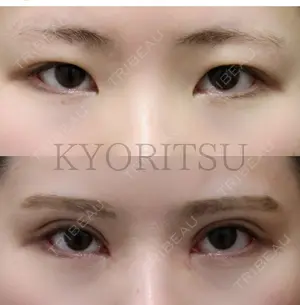 before image