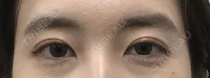 30 days after image
