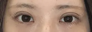 30 days after image