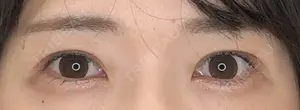 30 days after image