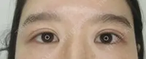 30 days after image