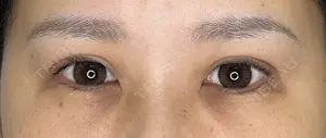 30 days after image