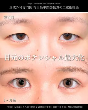 30 days after image