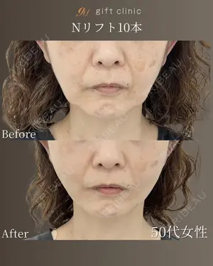 0 days after image