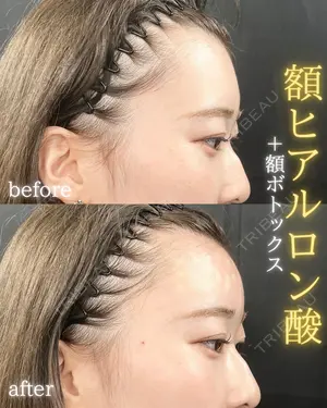 0 days after image