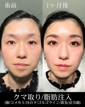 30 days after image