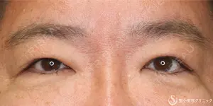 90 days after image