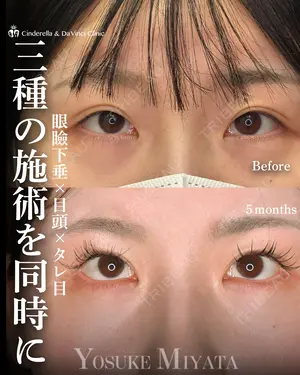 before image