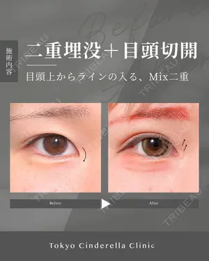 30 days after image
