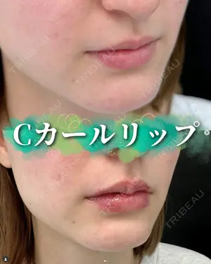 0 days after image