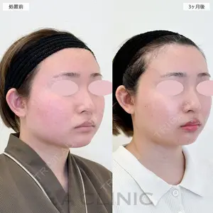 90 days after image