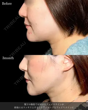 90 days after image