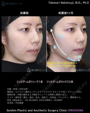 30 days after image