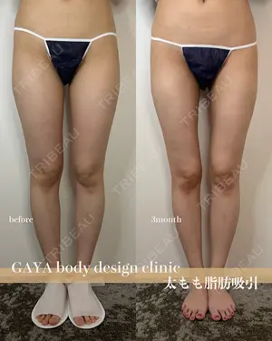 90 days after image