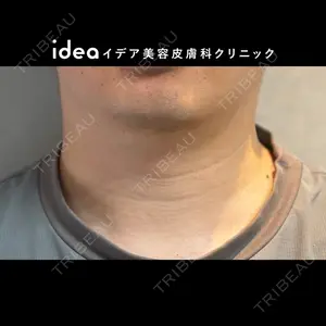 null days after image