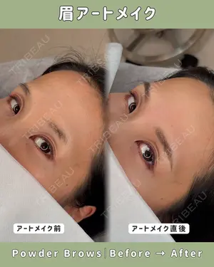 null days after image