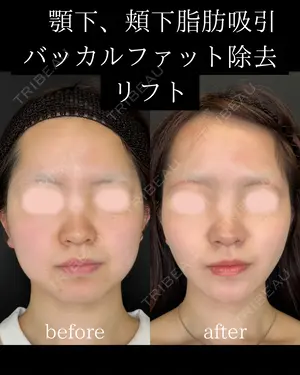 null days after image